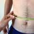 abdominal girth measurement